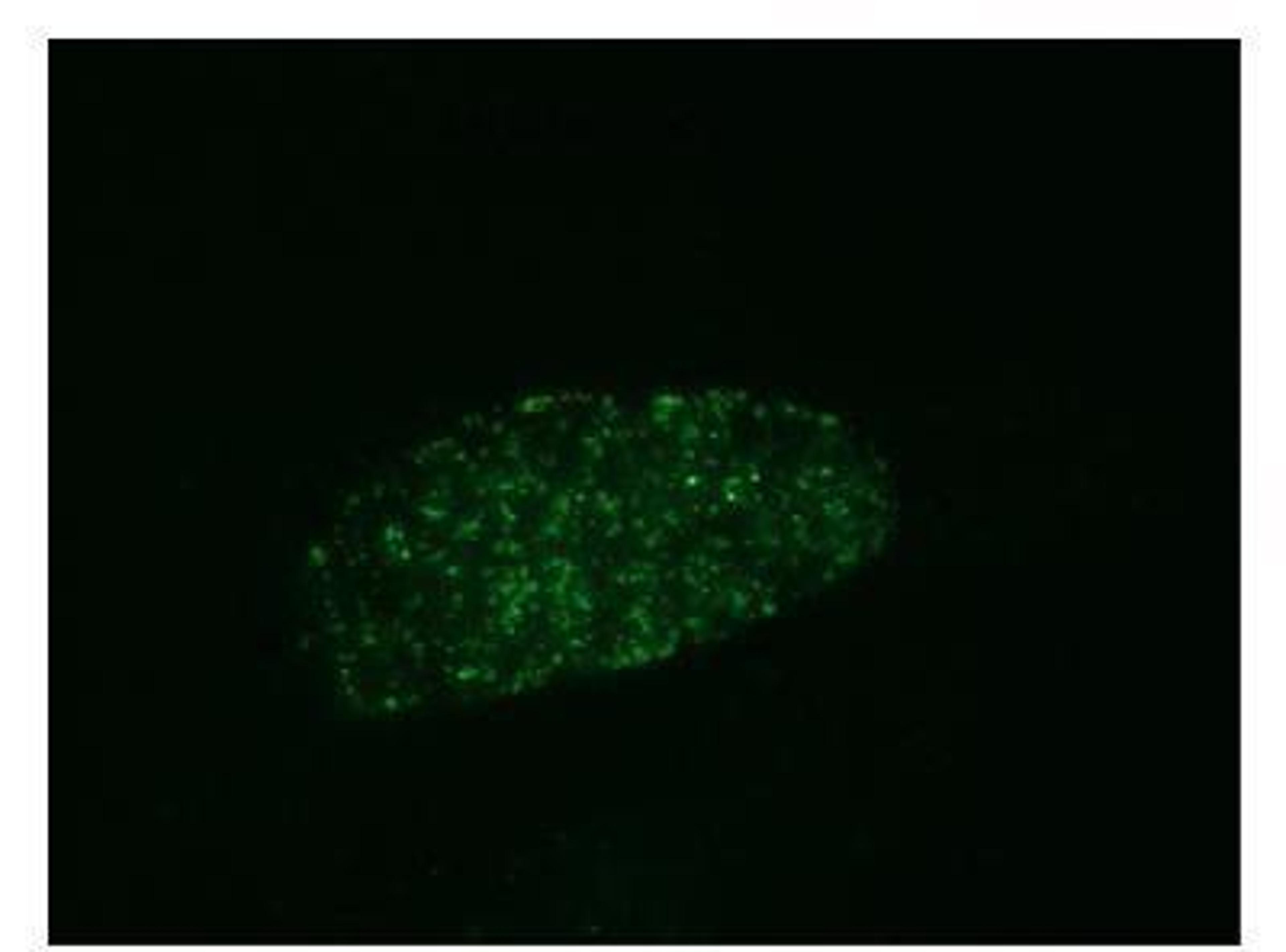 Immunocytochemistry/Immunofluorescence: RPA2 [p Ser33] Antibody [NB100-544] - Localization of phosphorylated RPA32 to foci following treatment with CPT. Samples: Asynchronous U2OS cells treated with CPT (1 uM, 1 hr). Antibody: NB 100-544 used at 2 ug/ml. Detection: FITC conjugated anti-rabbit IgG.