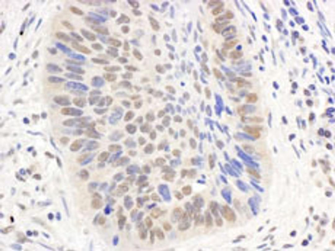 Detection of human p300 by immunohistochemistry.