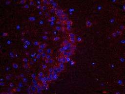 Immunofluorescence analysis of rat  brain hippocampus layer tissue using Melatonin receptor 1A antibody (dilution of primary antibody - 1:300)