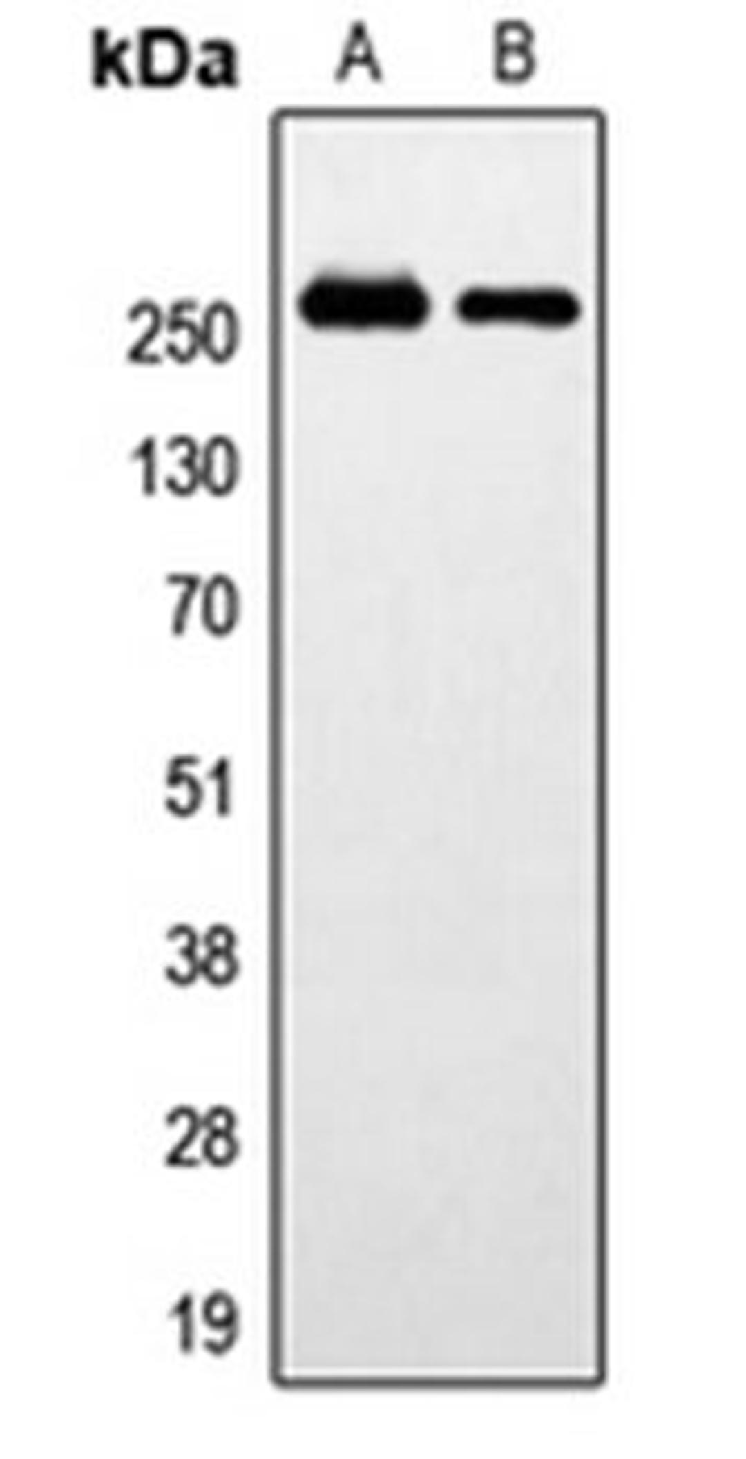 Western blot analysis of HeLa (Lane 1), SP2/0 (Lane 2) whole cell lysates using GPR179 antibody