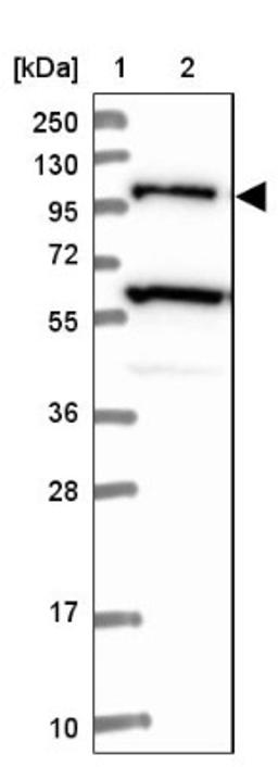 Western Blot: USP6NL Antibody [NBP1-83061] - Lane 1: Marker [kDa] 250, 130, 95, 72, 55, 36, 28, 17, 10<br/>Lane 2: Human cell line RT-4