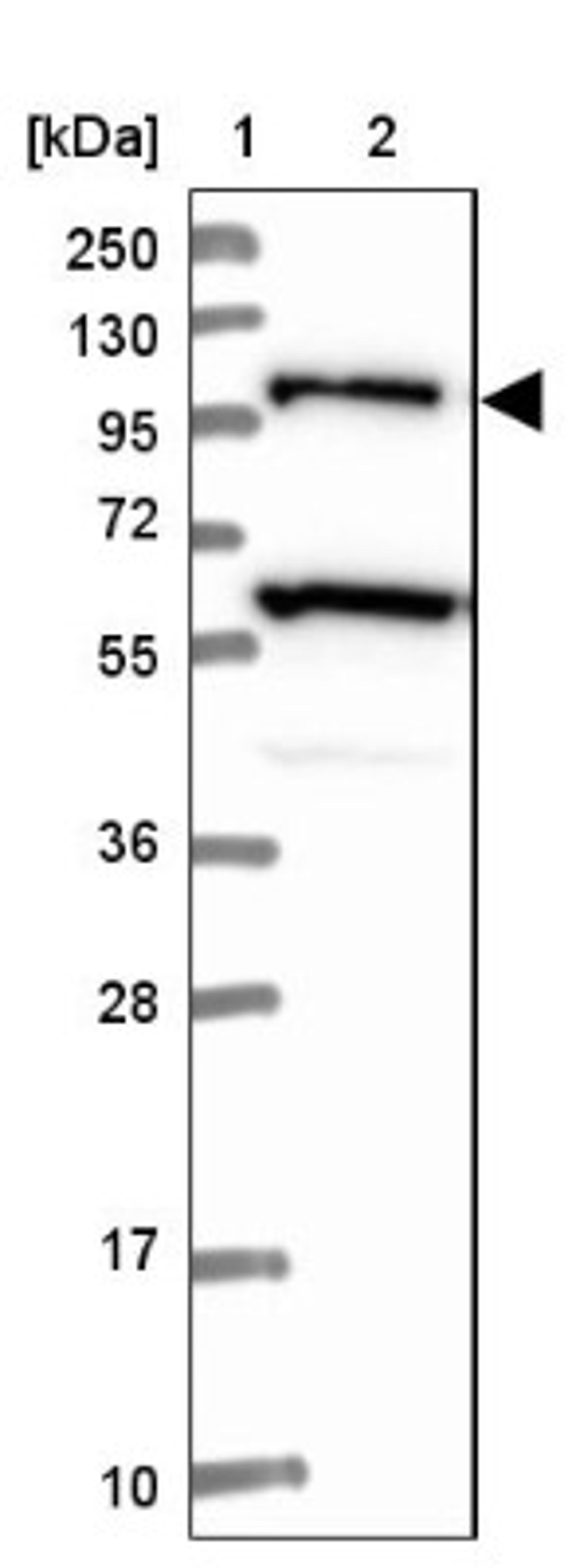 Western Blot: USP6NL Antibody [NBP1-83061] - Lane 1: Marker [kDa] 250, 130, 95, 72, 55, 36, 28, 17, 10<br/>Lane 2: Human cell line RT-4