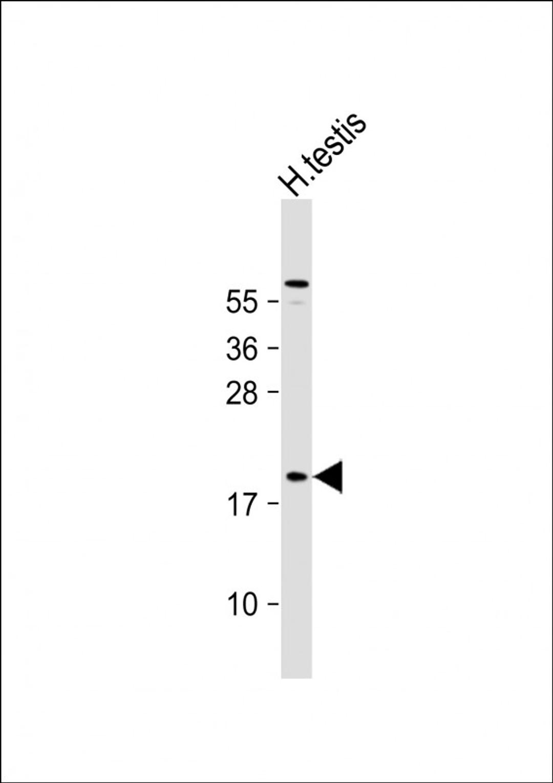 Western Blot at 1:1000 dilution + human testis lysate Lysates/proteins at 20 ug per lane.