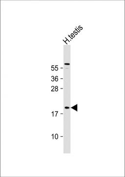 Western Blot at 1:1000 dilution + human testis lysate Lysates/proteins at 20 ug per lane.