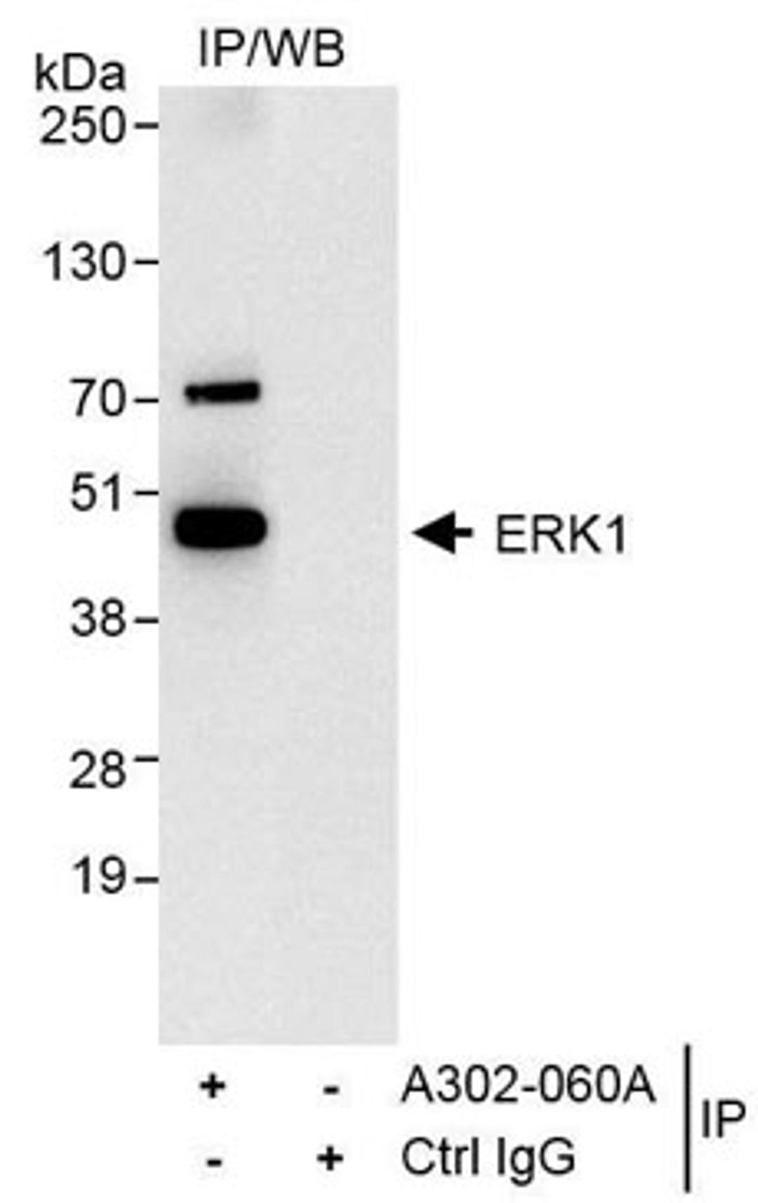 Detection of human ERK1 by western blot of immunoprecipitates.