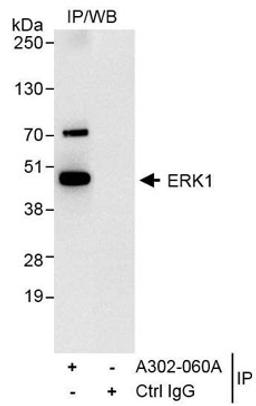 Detection of human ERK1 by western blot of immunoprecipitates.