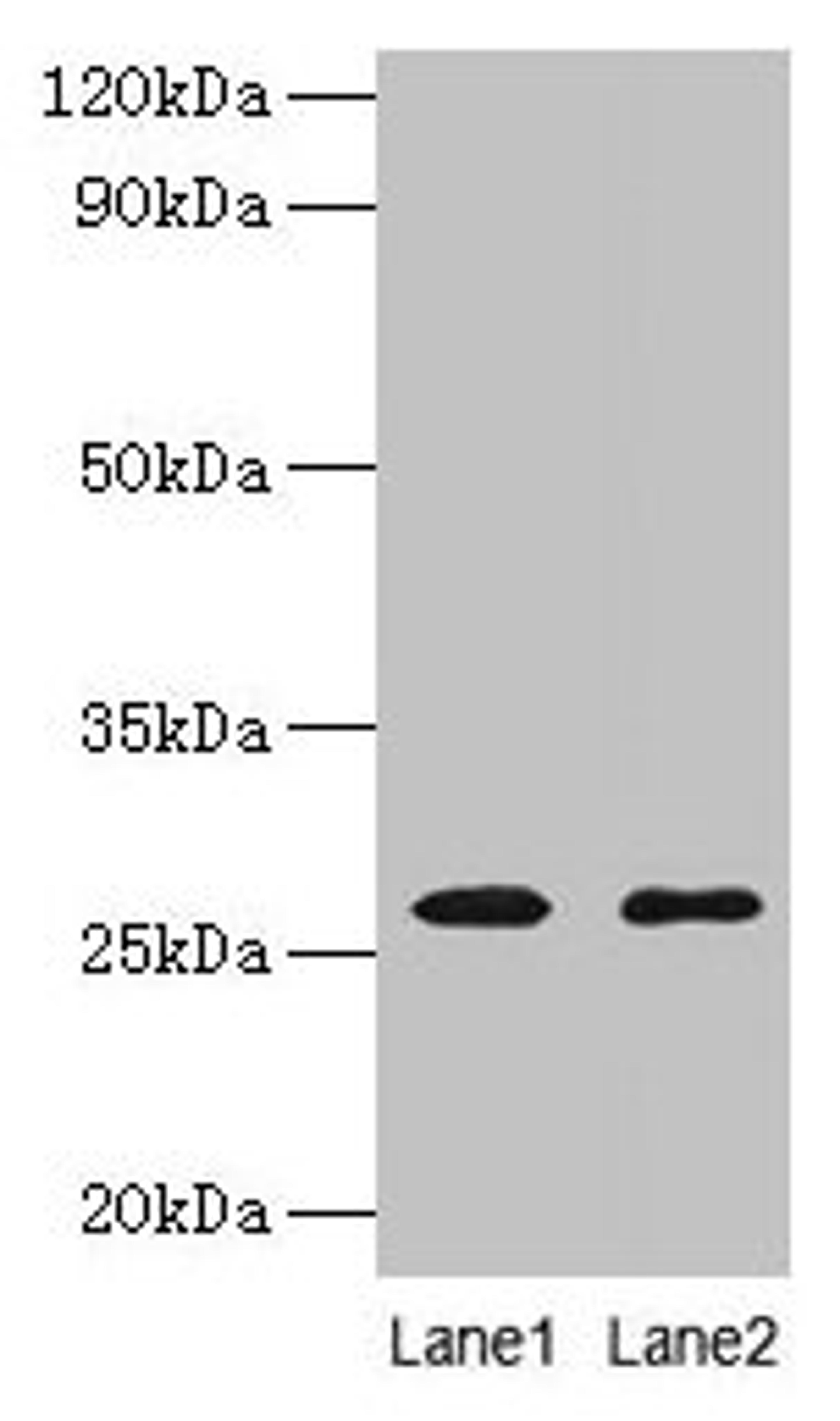 Western blot. All lanes: ADIPOQ antibody at 2µg/ml. Lane 1: NIH/3T3 whole cell lysate. Lane 2: HL60 whole cell lysate. Secondary. Goat polyclonal to rabbit IgG at 1/10000 dilution. Predicted band size: 27 kDa. Observed band size: 27 kDa