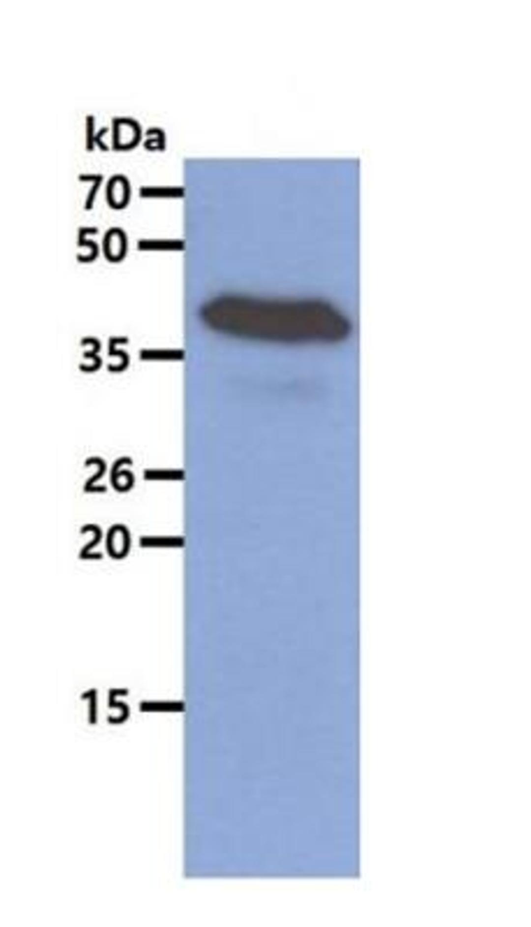 Chitinase 3-like 1 Antibody (2C10) [NBP1-28610] - SW480 cell lysate (40ug) was resolved by SDS-PAGE, transferred to PVDF membrane and probed with anti-human CHI3L1 (1:500). Proteins were visualized using a goat anti-mouse secondary antibody conjugated to HRP and an ECL detection system.