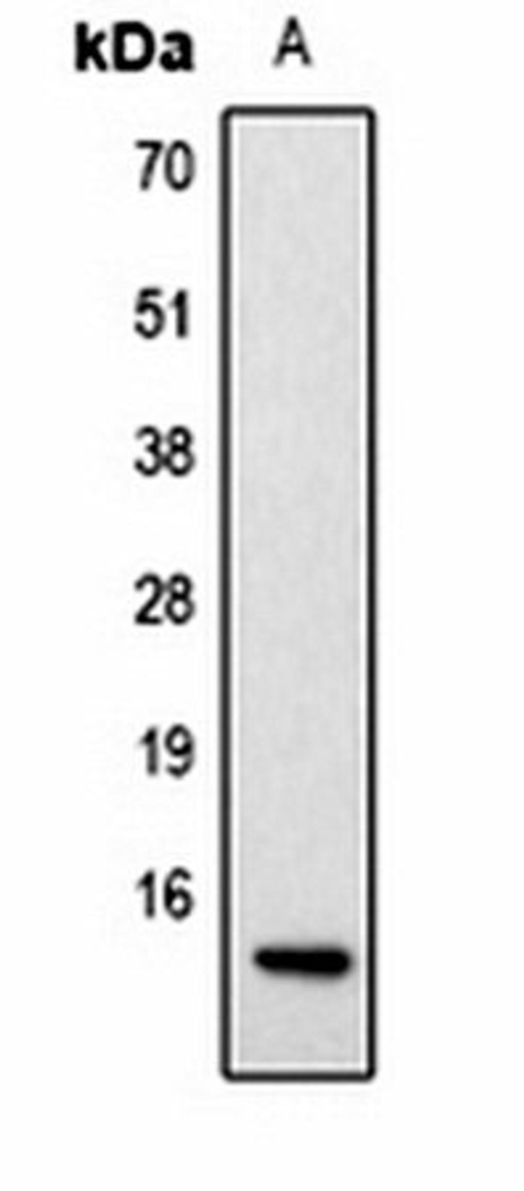 Western blot analysis of Hela TSA-treated (Lane1) whole cell lysates using Histone H2A (AcK9) antibody