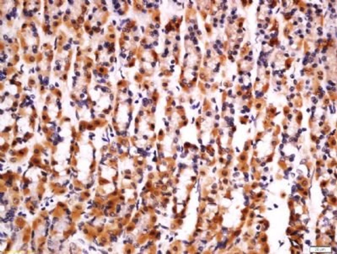 Immunohistochemical staining of rat stomach tissue using IL33 antibody.