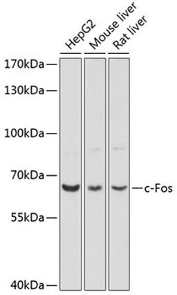 Western blot - c-Fos antibody (A16641)