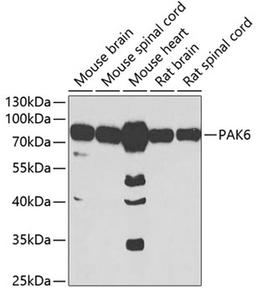 Western blot - PAK6 antibody (A7821)