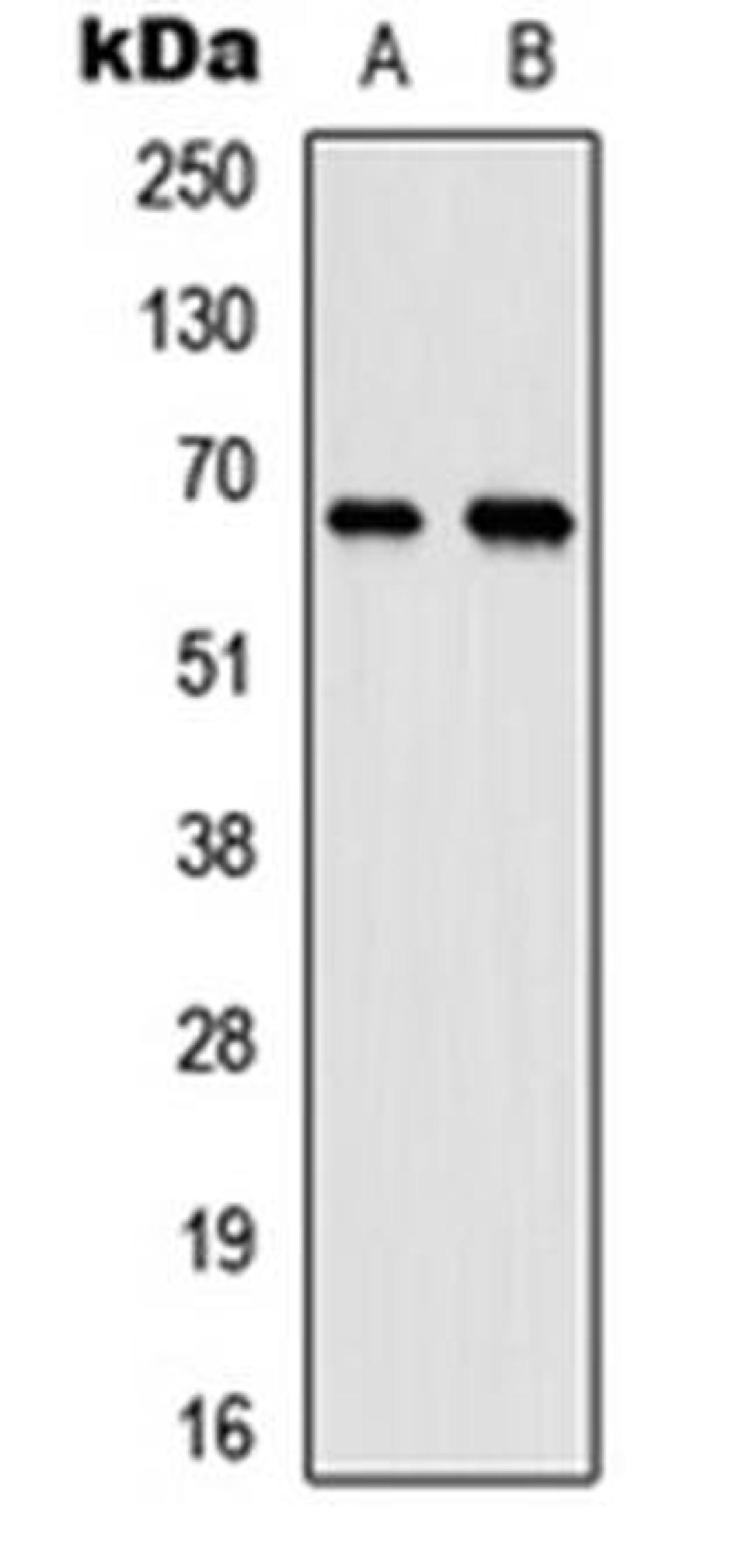 Western blot analysis of HeLa (Lane1), mouse testis (Lane2) whole cell using MEN antibody