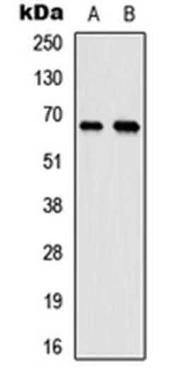 Western blot analysis of HeLa (Lane1), mouse testis (Lane2) whole cell using MEN antibody