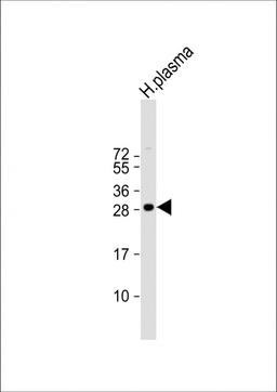 Western Blot at 1:1000 dilution + human plasma lysate Lysates/proteins at 20 ug per lane.