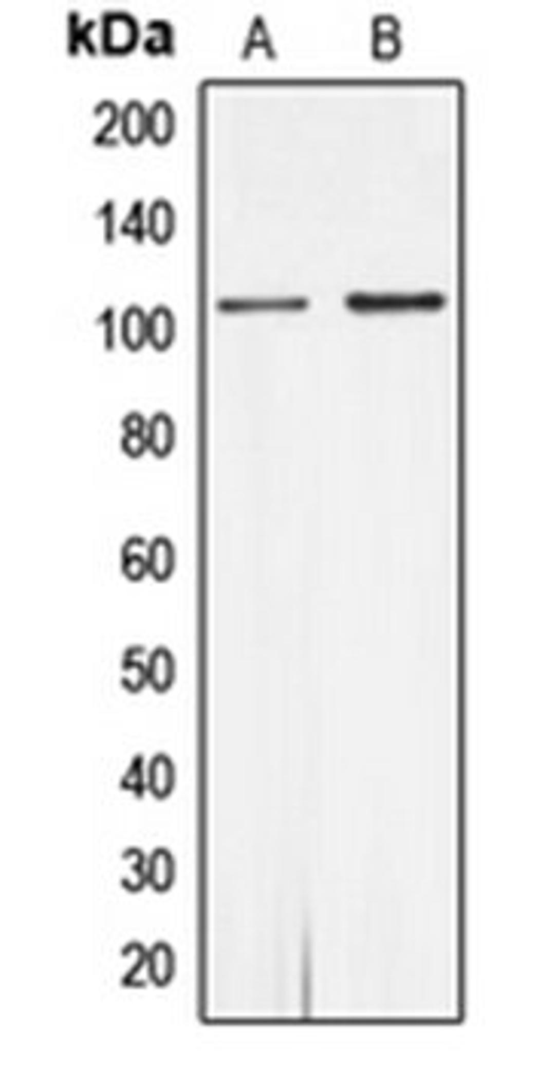 Western blot analysis of MCF7 (Lane 1), rat heart (Lane 2) whole cell lysates using AR antibody