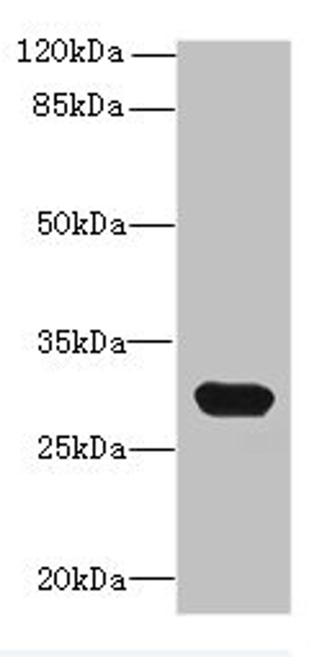 Western blot. All lanes: C1QTNF6 antibody at 8ug/ml + Mouse brain tissue. Secondary. Goat polyclonal to rabbit IgG at 1/10000 dilution. Predicted band size: 29, 31, 18 kDa. Observed band size: 29 kDa. 