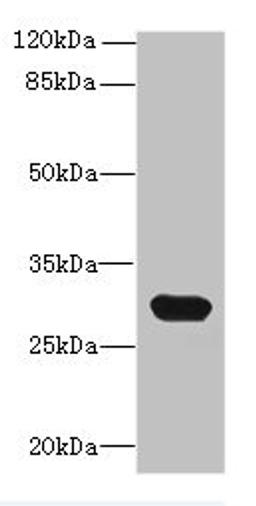Western blot. All lanes: C1QTNF6 antibody at 8ug/ml + Mouse brain tissue. Secondary. Goat polyclonal to rabbit IgG at 1/10000 dilution. Predicted band size: 29, 31, 18 kDa. Observed band size: 29 kDa. 