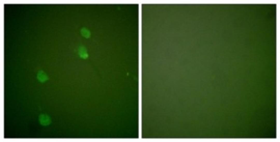 Immunocytochemistry/Immunofluorescence: Cullin 2 Antibody [NBP1-67535] - Analysis of NIH-3T3 cells, using Cullin 2 Antibody. The picture on the right is treated with the synthesized peptide.