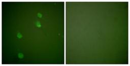 Immunocytochemistry/Immunofluorescence: Cullin 2 Antibody [NBP1-67535] - Analysis of NIH-3T3 cells, using Cullin 2 Antibody. The picture on the right is treated with the synthesized peptide.