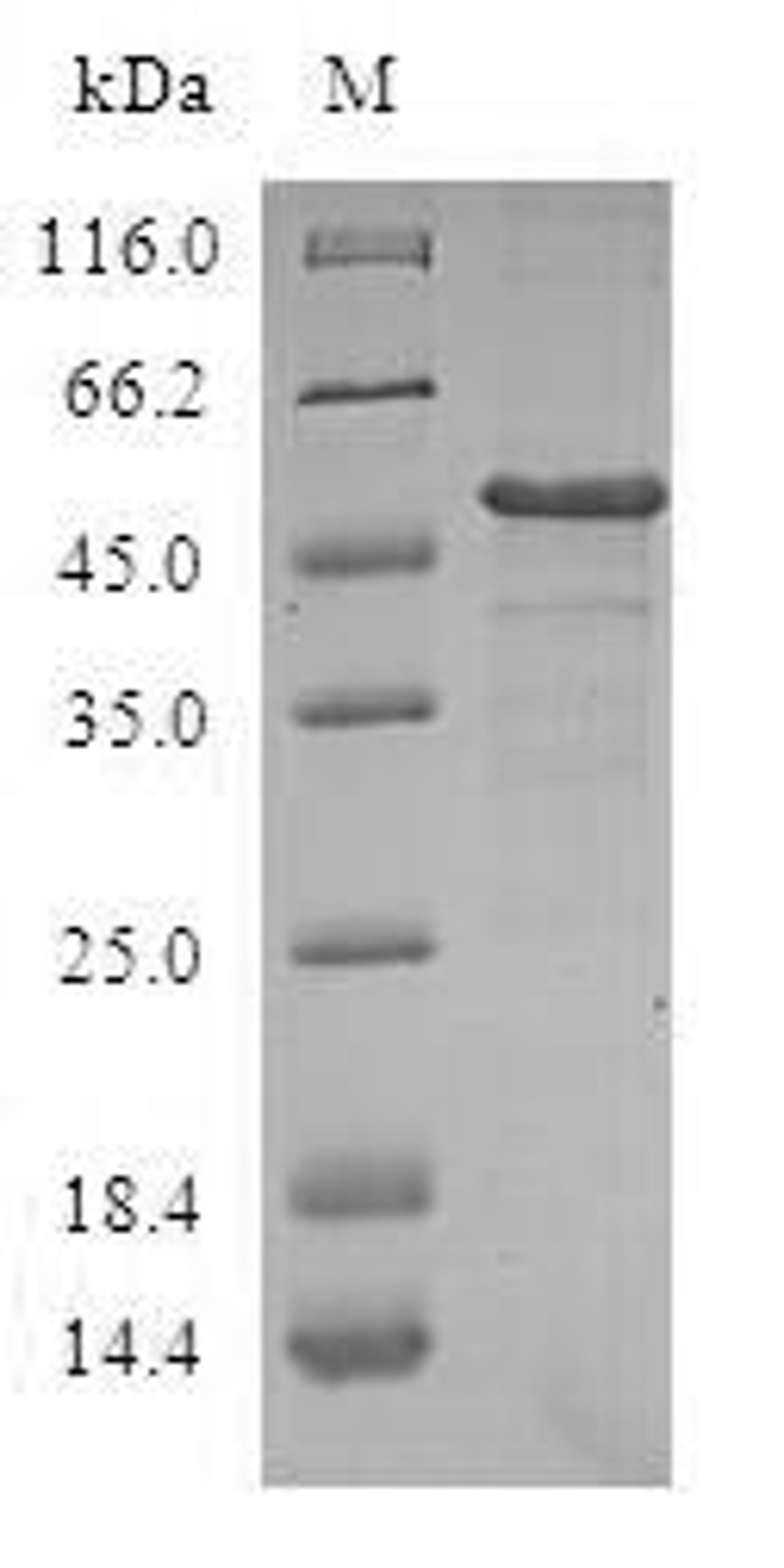 (Tris-Glycine gel) Discontinuous SDS-PAGE (reduced) with 5% enrichment gel and 15% separation gel.