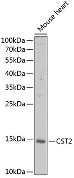 Western blot - CST2 antibody (A6571)