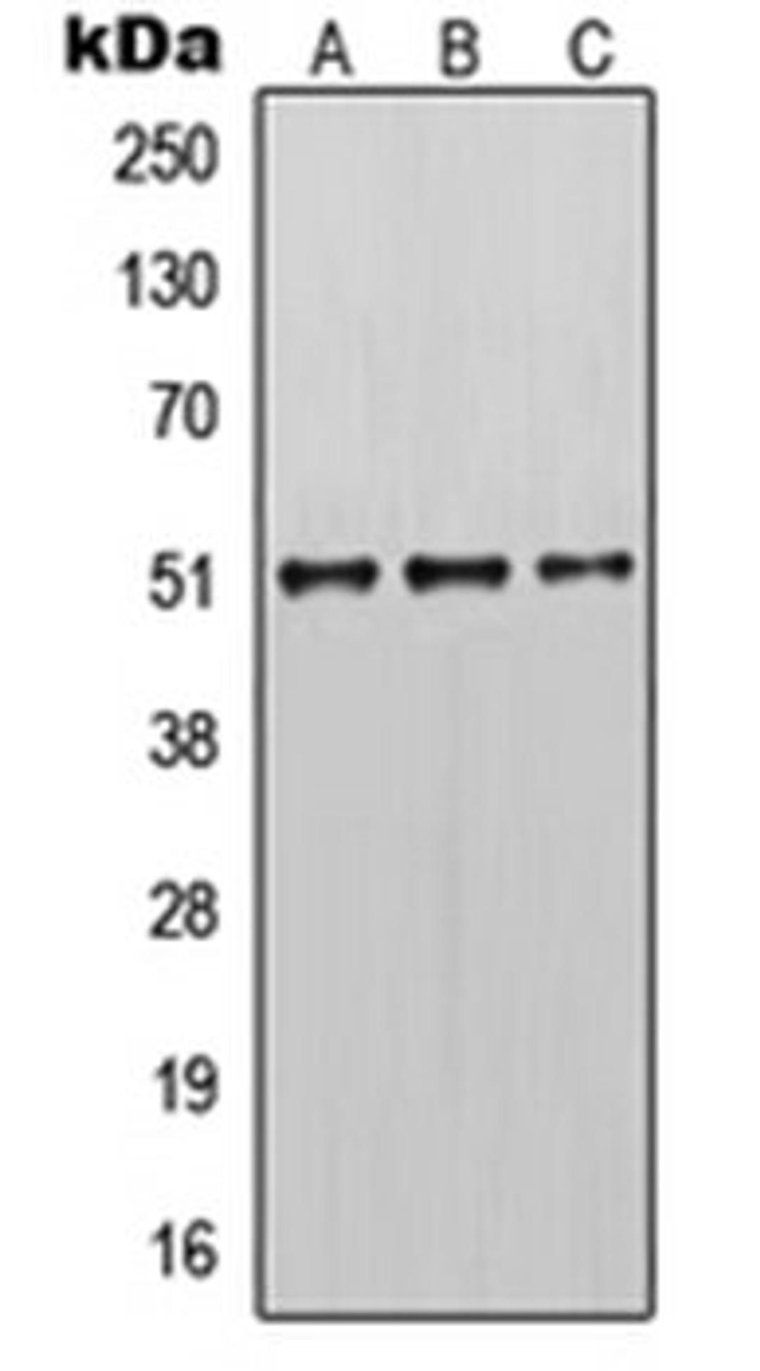 Western blot analysis of MCF7 (Lane 1), mouse brain (Lane 2), rat brain (Lane 3) whole cell lysates using KRT14 antibody