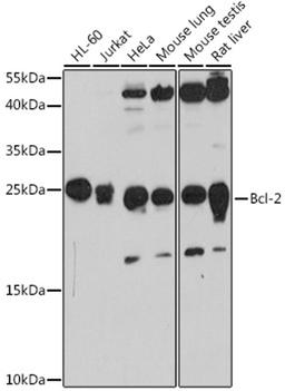 Western blot - Bcl-2 antibody (A11025)