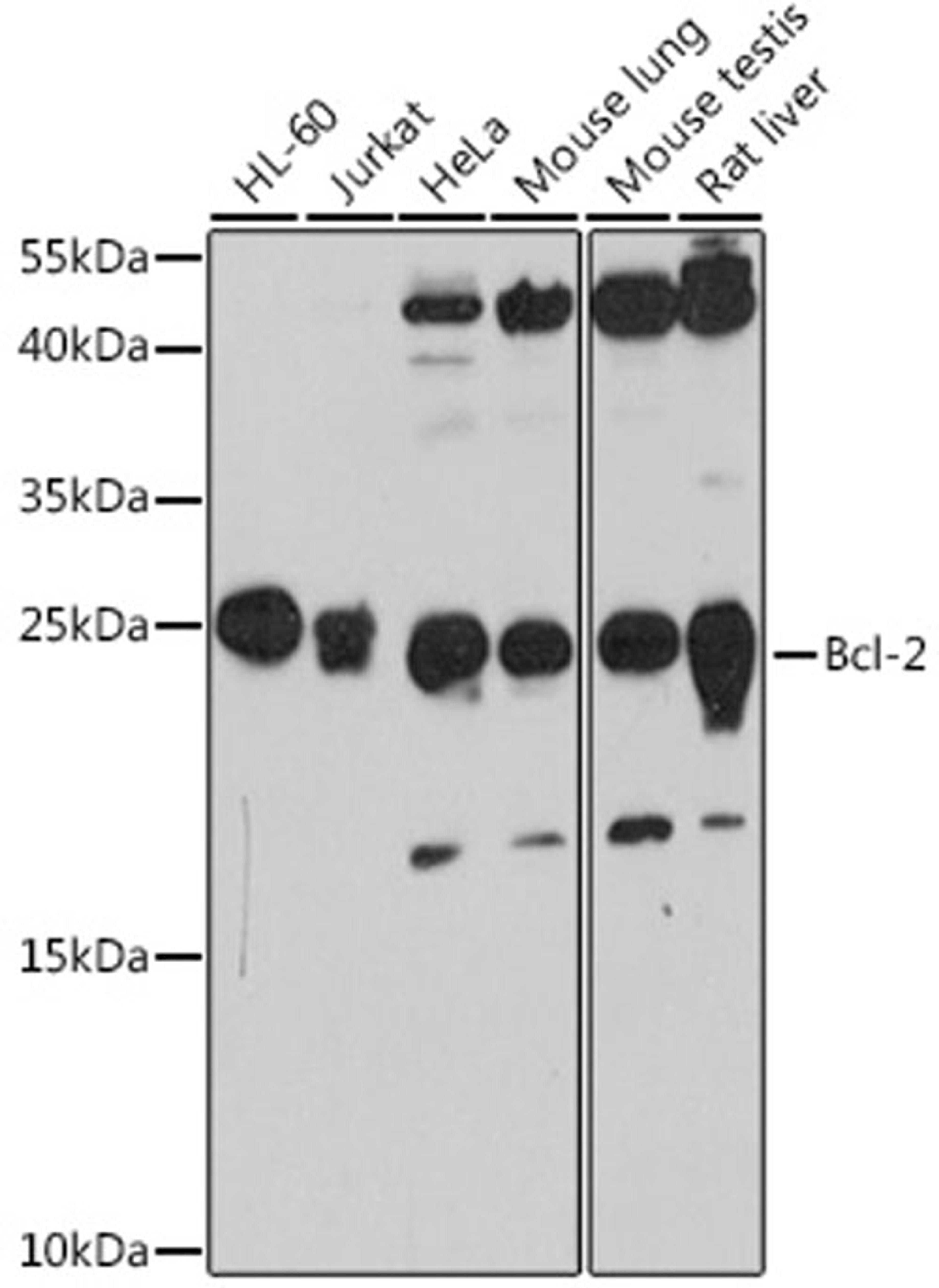 Western blot - Bcl-2 antibody (A11025)