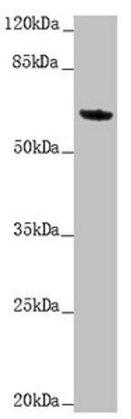 Western blot. All lanes: KRT6A antibody at 5.06 ug/ml + Mouse lung tissue. Secondary. Goat polyclonal to rabbit IgG at 1/10000 dilution. Predicted band size: 60 kDa. Observed band size: 60 kDa.