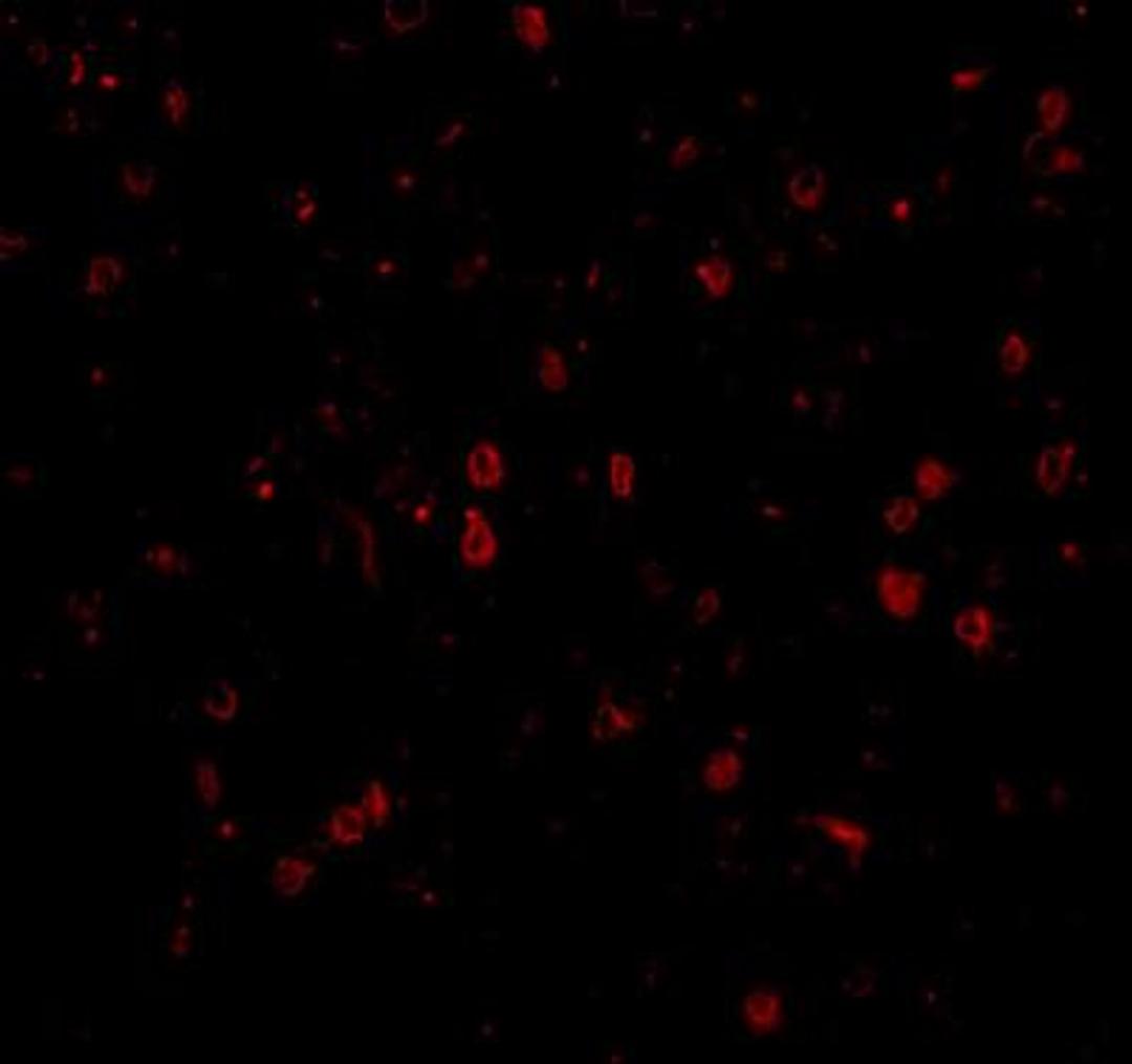 Immunocytochemistry/Immunofluorescence: NPAS3 Antibody [NBP1-76785] - Immunofluorescence of NPAS3 in human brain tissue with NPAS3 antibody at 20 ug/mL.