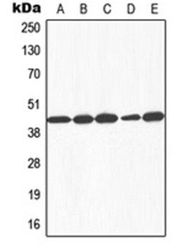 Western blot analysis of HEK293T (Lane 1), HepG2 (Lane 2), SP2/0 (Lane 3), rat liver (Lane 4), Human liver (Lane 5) whole cell lysates using GALK1 antibody