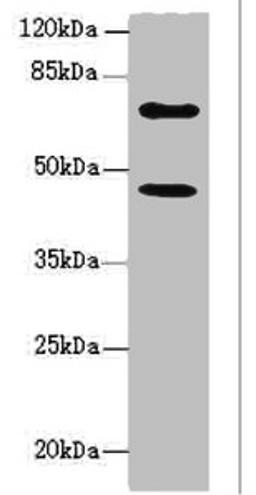 Western blot. All lanes: TM9SF1 antibody at 6.93ug/ml + U251 whole cell lysate. Secondary. Goat polyclonal to rabbit IgG at 1/10000 dilution. Predicted band size: 69, 56 kDa. Observed band size: 69, 46 kDa. 