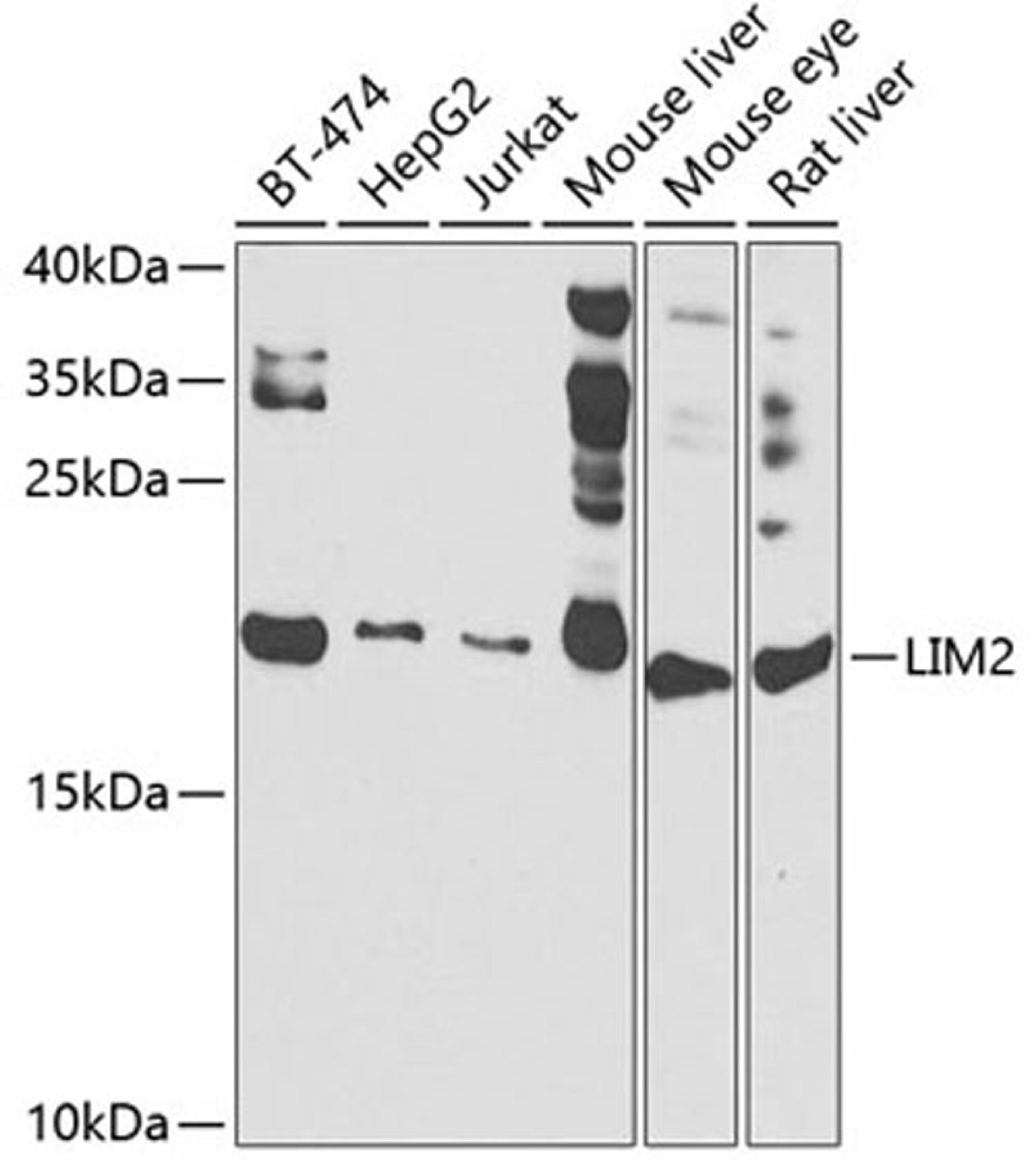 Western blot - LIM2 antibody (A7909)