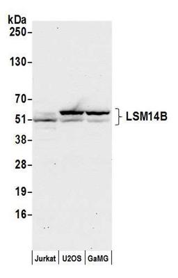 Detection of human LSM14B by WB.