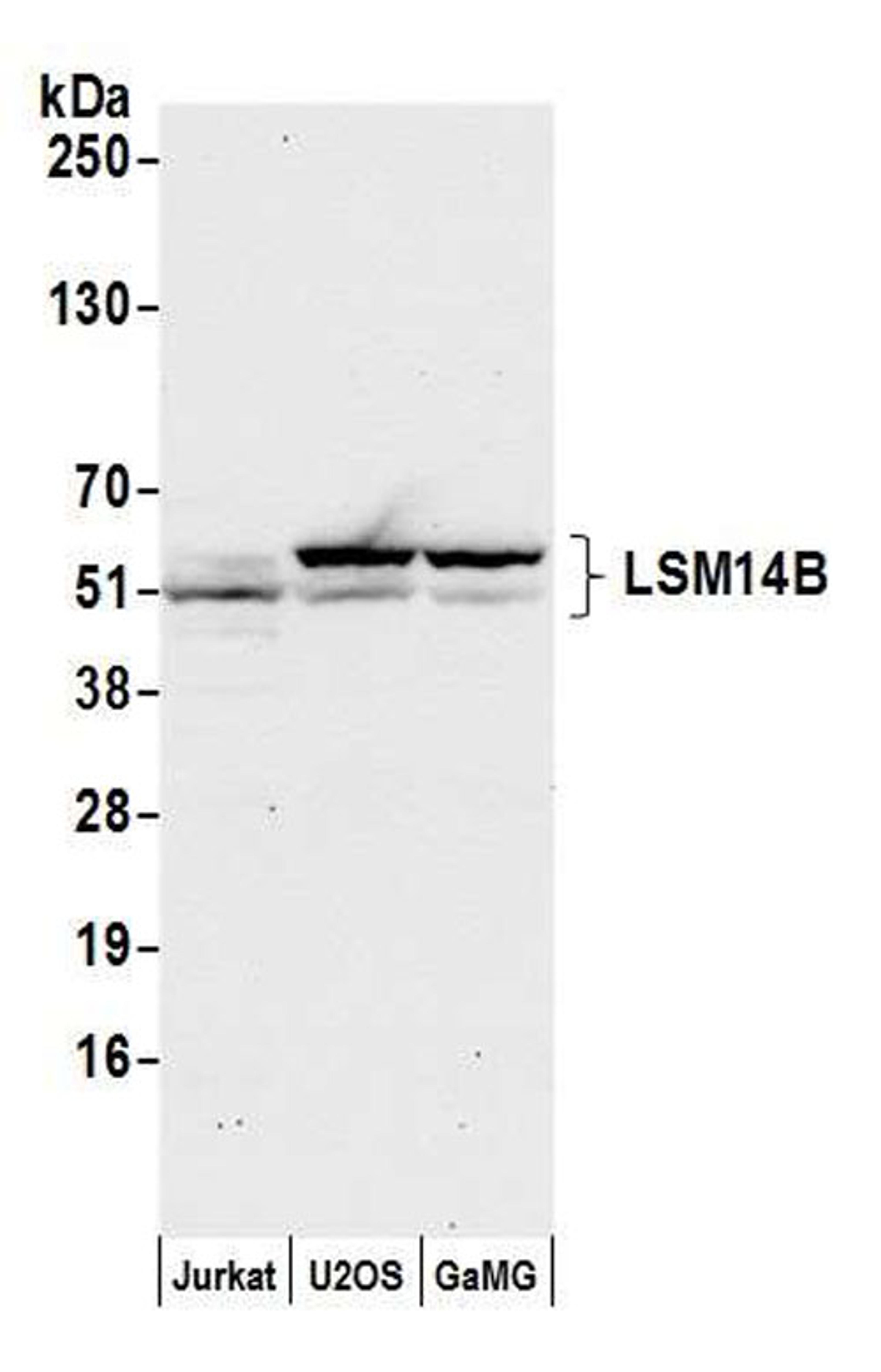 Detection of human LSM14B by WB.