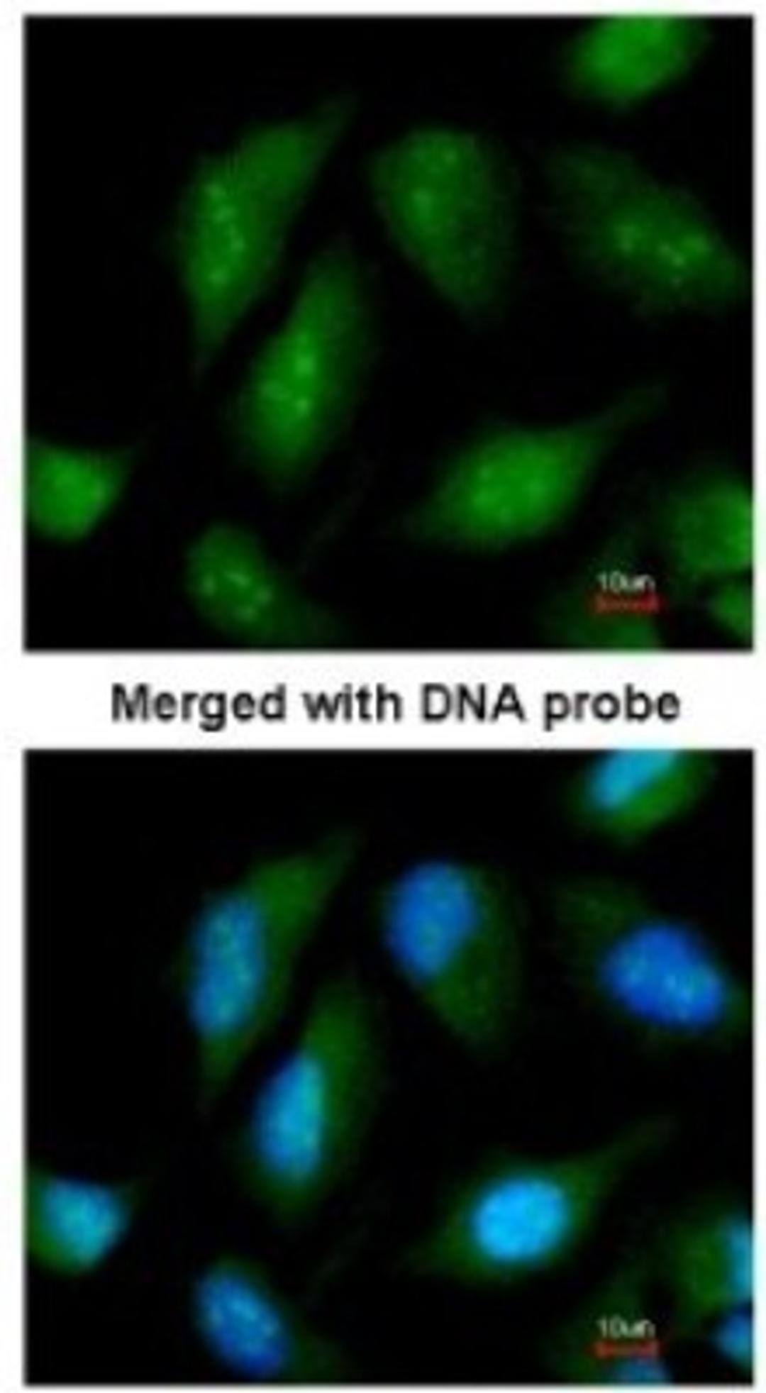 Immunocytochemistry/Immunofluorescence: NR0B1 Antibody [NBP1-32832] - Paraformaldehyde-fixed HeLa, using antibody at 1:200 dilution.