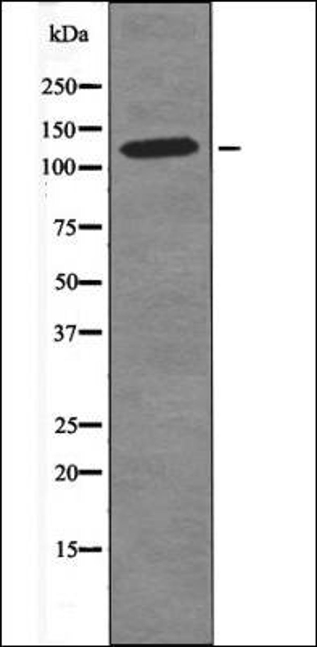 Western blot analysis of LOVO whole cell lysates using MAP4 -Phospho-Ser696- antibody