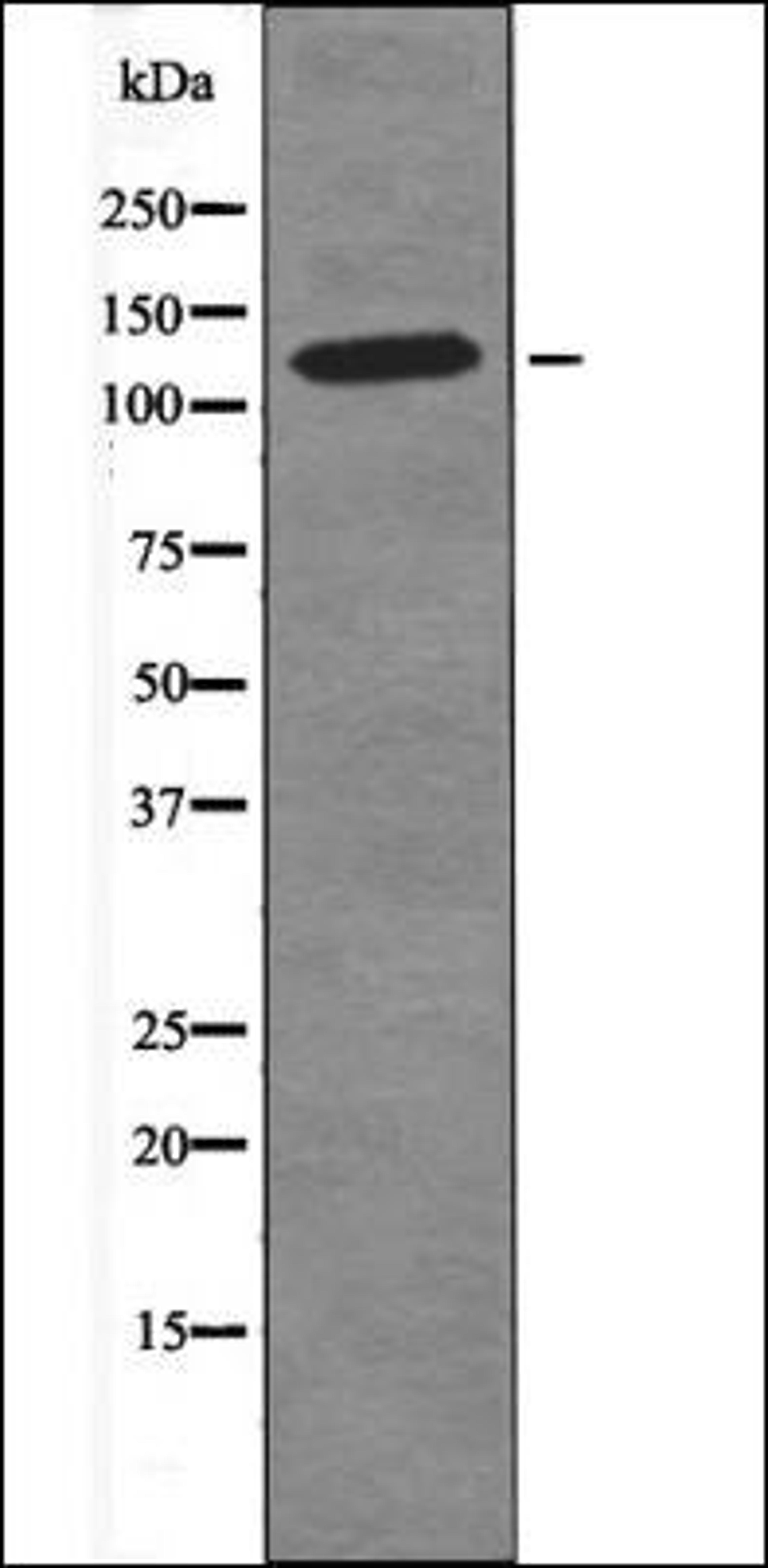 Western blot analysis of LOVO whole cell lysates using MAP4 -Phospho-Ser696- antibody