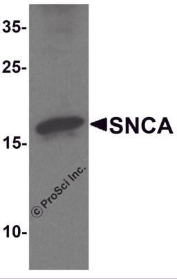 Western blot analysis of SNCA in mouse cerebellum tissue lysate with SNCA antibody at 1 &#956;g/ml.