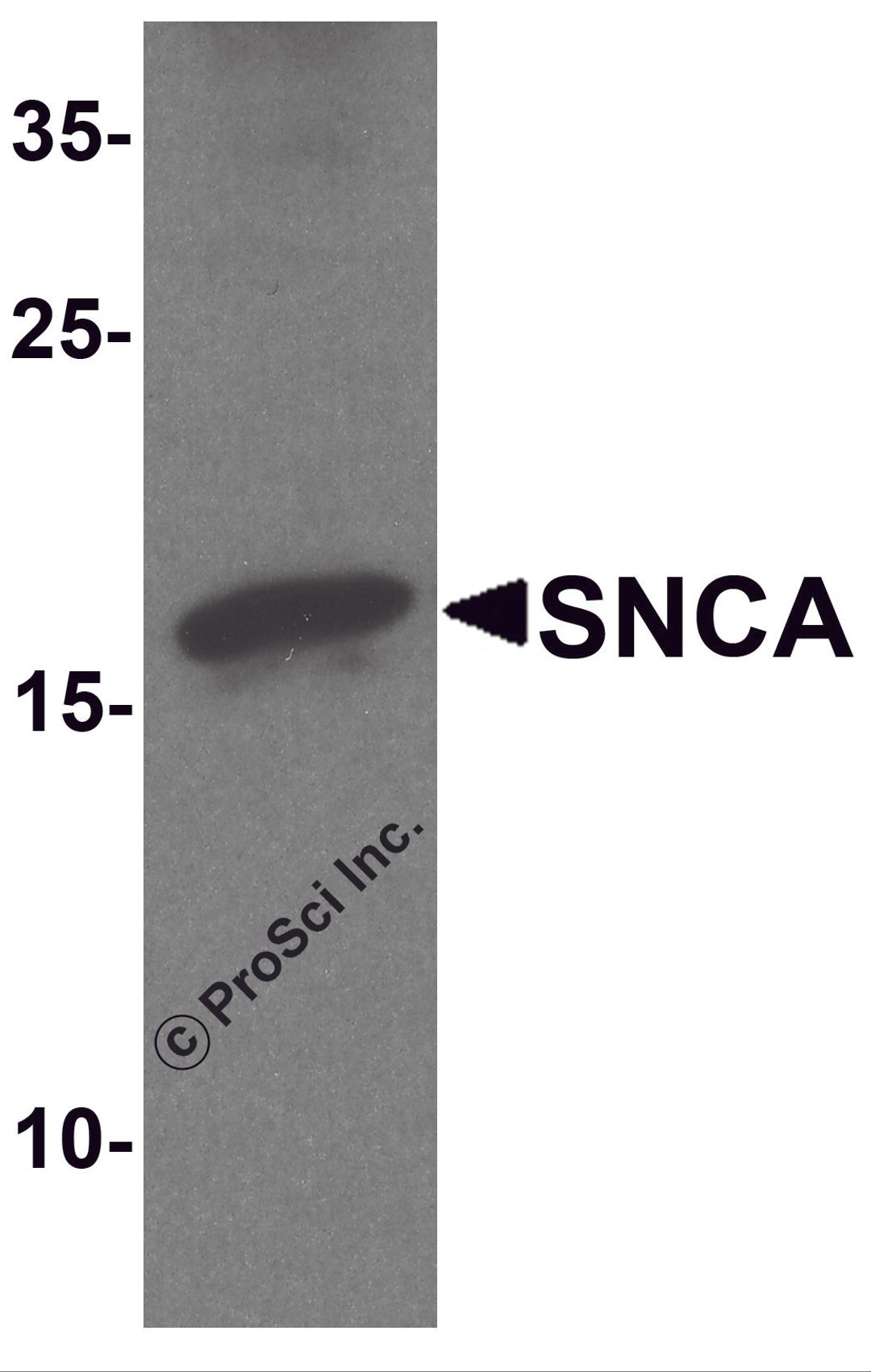 Western blot analysis of SNCA in mouse cerebellum tissue lysate with SNCA antibody at 1 μg/ml.