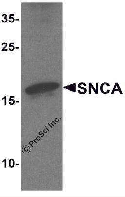 Western blot analysis of SNCA in mouse cerebellum tissue lysate with SNCA antibody at 1 μg/ml.