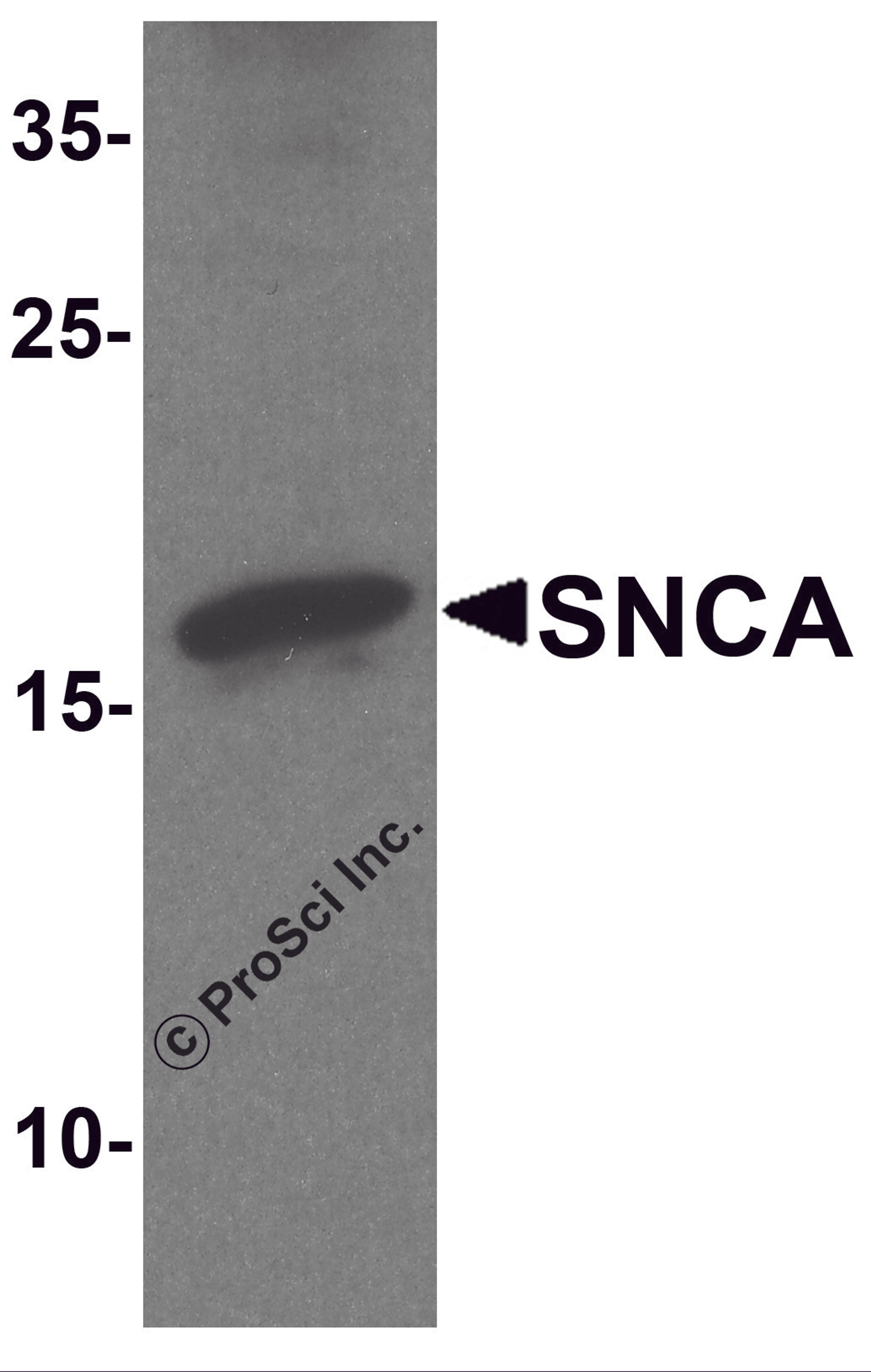 Western blot analysis of SNCA in mouse cerebellum tissue lysate with SNCA antibody at 1 μg/ml.