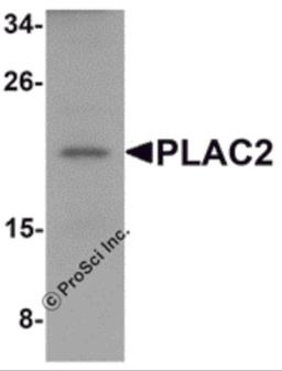 Western blot analysis of PLAC2 in HeLa cell lysate with PLAC2 antibody at 1 μg/mL.