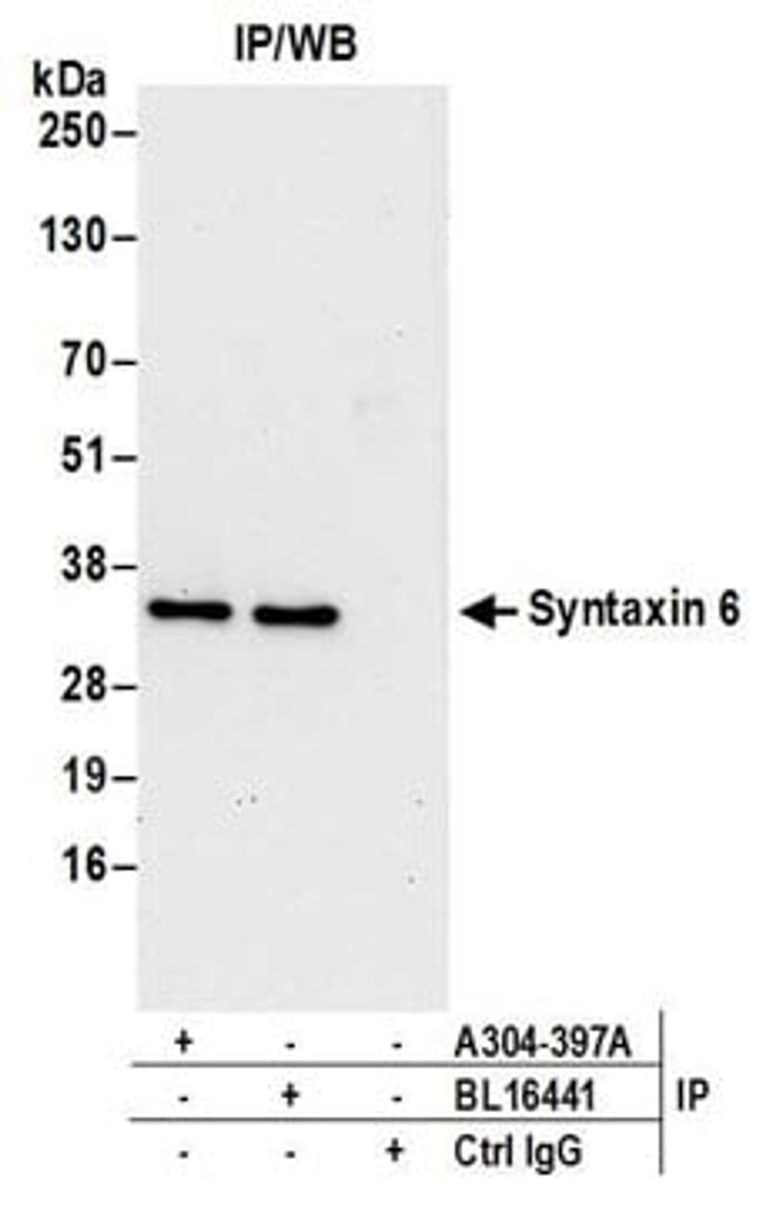 Detection of human Syntaxin 6 by western blot of immunoprecipitates.