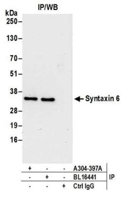 Detection of human Syntaxin 6 by western blot of immunoprecipitates.