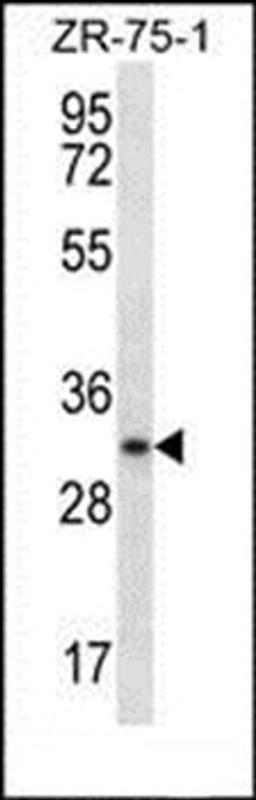 Western blot analysis of ZR-75-1 cell line lysates (35ug/lane) using MYOGENIN antibody (N-term)