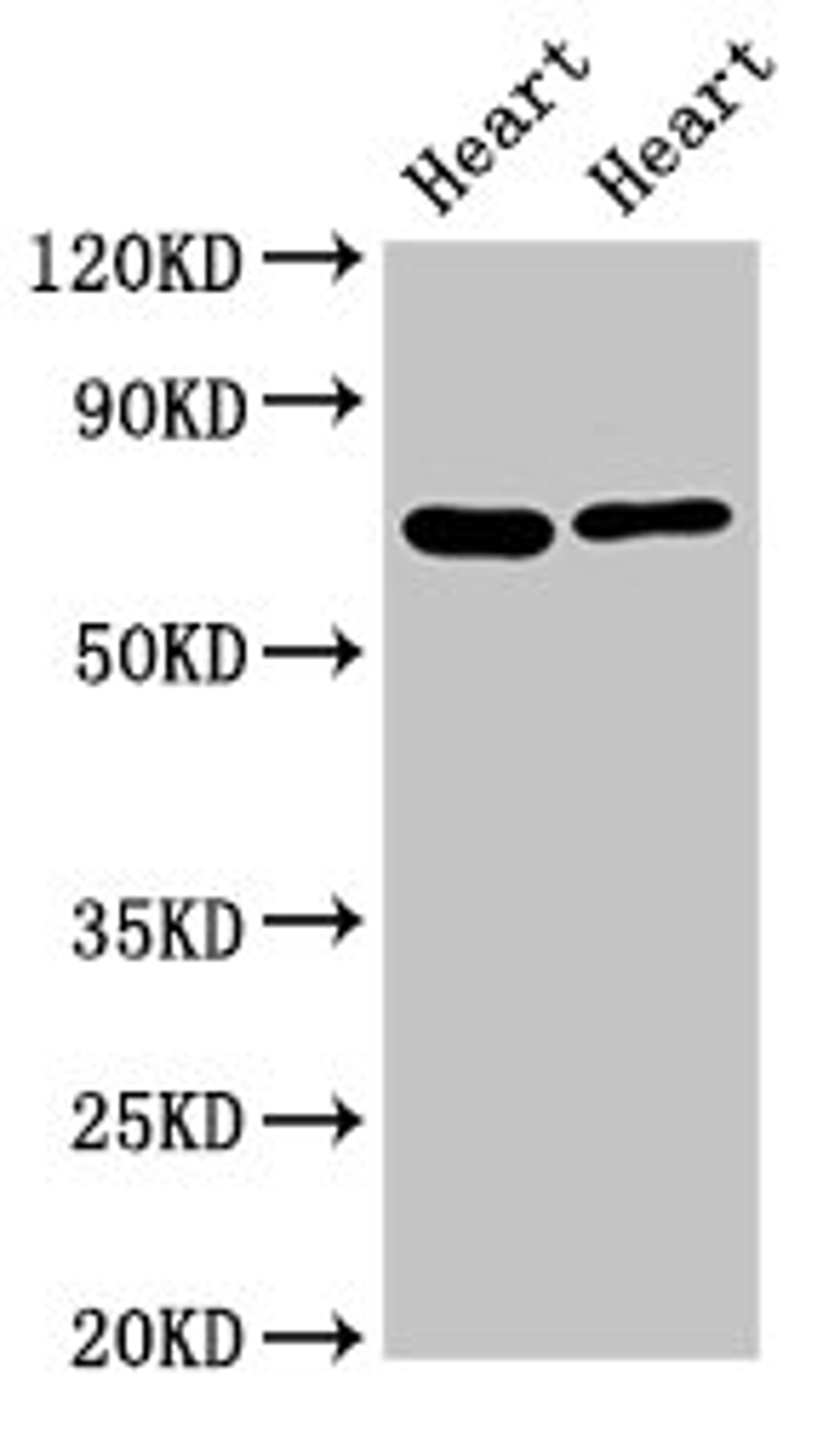 Western Blot. Positive WB detected in: Rat heart tisseu, Mouse heart tissue. All lanes: FASTKD2 antibody at 8ug/ml. Secondary. Goat polyclonal to rabbit IgG at 1/50000 dilution. Predicted band size: 82, 75 kDa. Observed band size: 75 kDa. 