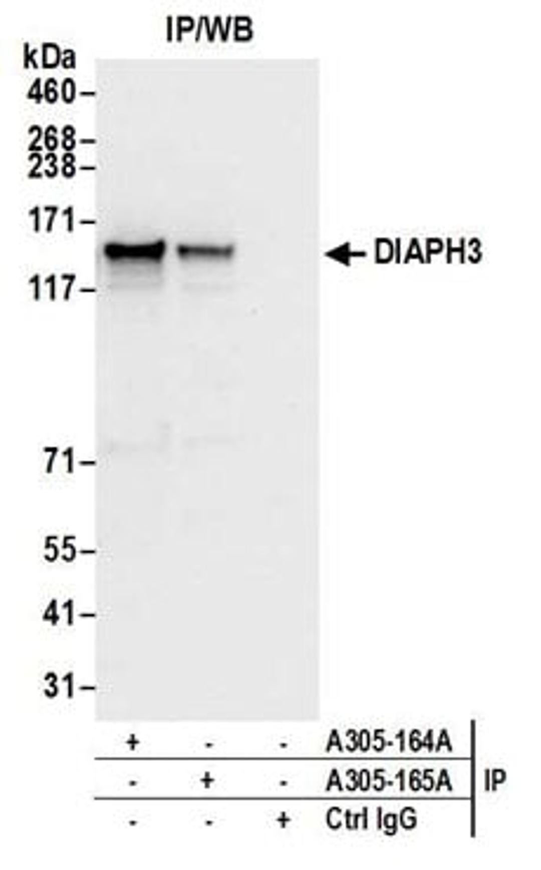 Detection of human DIAPH3 by western blot of immunoprecipitates.