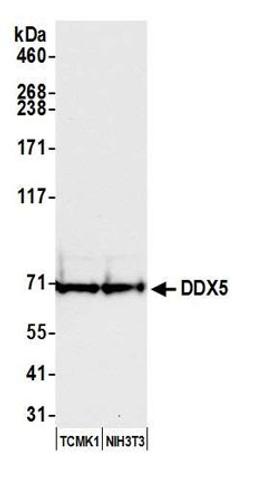 Detection of mouse DDX5 by western blot.